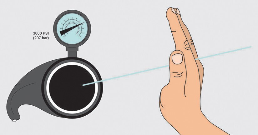 Where do fluid-injection injuries come from? Fluid-injection injuries