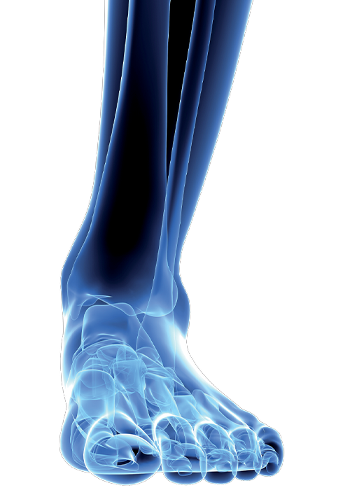can safety footwear prevent ankle twisting