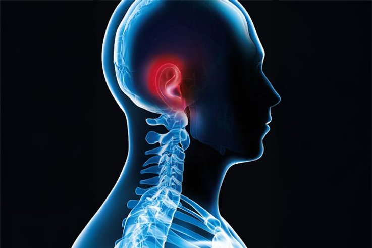 Real impact of hearing loss