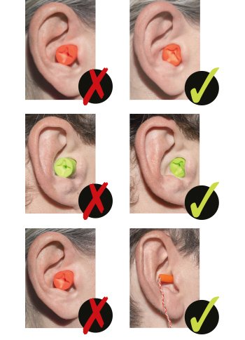 earplug fitting