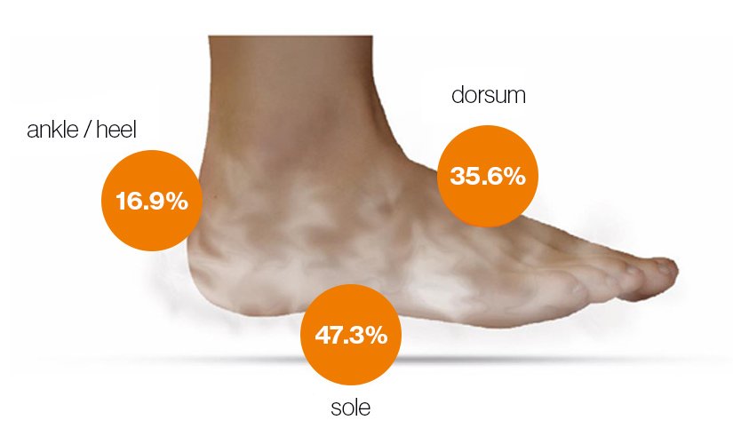 The distribution of sweat glands on the foot
