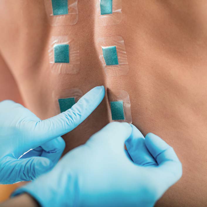 Application of test strips onto the skin of a person's back to test for skin compatibility 
