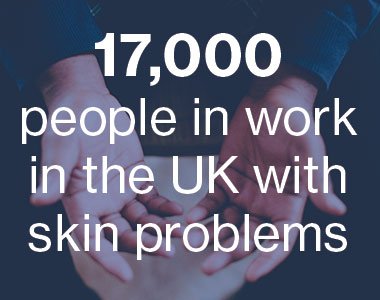 17,000 people in work in the UK with skin problems