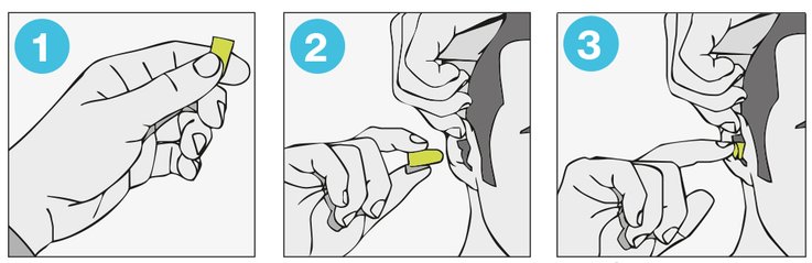 Einsetzen eines uvex Einweggehörschutzstöpsels