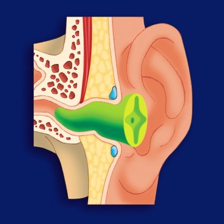 Cross section of a uvex earplug in an ear canal