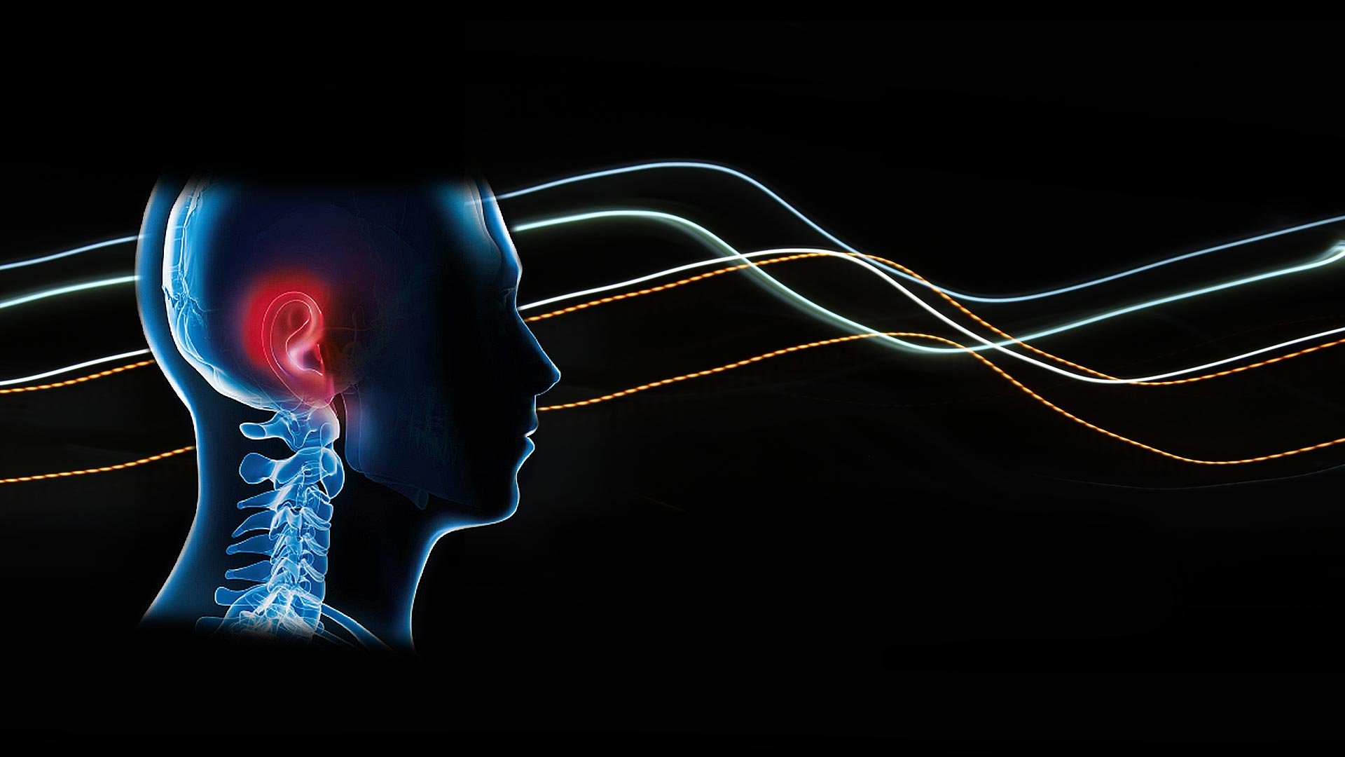 Noise-induced hearing loss